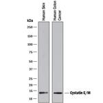 Cystatin M Monoclonal Antibody (211515)