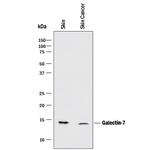 Galectin 7 Monoclonal Antibody (950756)