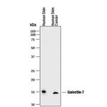 Galectin 7 Monoclonal Antibody (950723)