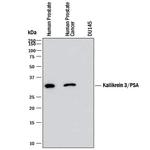 PSA Monoclonal Antibody (989729)