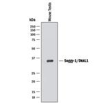 DKKL1 Monoclonal Antibody (192425)