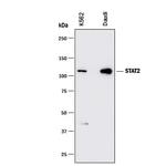 STAT2 Antibody in Western Blot (WB)