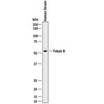 Fetuin B Monoclonal Antibody (212621)