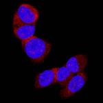 LRIG2 Monoclonal Antibody (990332)