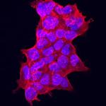 GDF11 Monoclonal Antibody (937320)