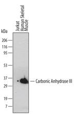 Carbonic Anhydrase III Monoclonal Antibody (495018)