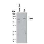 TAP2 Monoclonal Antibody (998524)