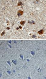 Phospho-Amyloid Precursor Protein (Thr668) Monoclonal Antibody (304904)