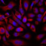 Pleiotrophin Antibody in Immunocytochemistry (ICC/IF)