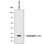 Cardiotrophin 1 Monoclonal Antibody (89221)