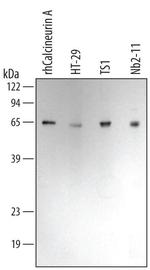 Calcineurin A Monoclonal Antibody (302202)