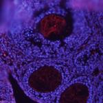 BMP-15 Monoclonal Antibody (317809)