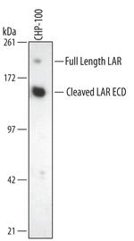 PTPRF Monoclonal Antibody (384727)