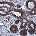 ICAT Antibody in Immunohistochemistry (Paraffin) (IHC (P))