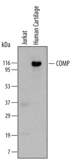 COMP Monoclonal Antibody (2127-F5)