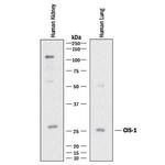 CIS Monoclonal Antibody (989616)