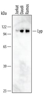 PTPN22 Monoclonal Antibody (340113)