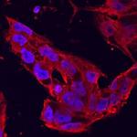 DISP1 Antibody in Immunocytochemistry (ICC/IF)