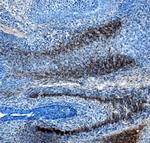 SLIT3 Monoclonal Antibody (782619)