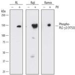 Phospho-PLCG2 (Tyr753) Monoclonal Antibody (790623)