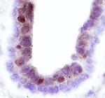 FRK Monoclonal Antibody (393812)