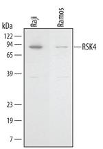 RSK4 Monoclonal Antibody (374521)