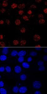 MYF5 Antibody in Immunocytochemistry (ICC/IF)