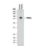 Protein S Monoclonal Antibody (391609)