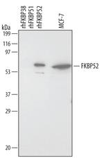 FKBP4 Monoclonal Antibody (425123)