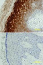 BACE2 Monoclonal Antibody (391017)