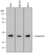 Annexin A4 Monoclonal Antibody (694624)