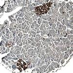 SERPINB8 Monoclonal Antibody (423023)