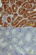 CADM4 Monoclonal Antibody (404617)