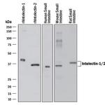 ITLN1/ITLN2 Monoclonal Antibody (450515)