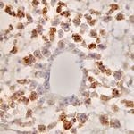 SAA4 Monoclonal Antibody (398104)