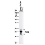 FSH beta Monoclonal Antibody (961416)