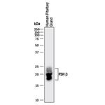 FSH beta Monoclonal Antibody (961417)