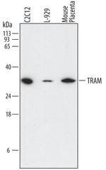 TICAM2 Monoclonal Antibody (757706)