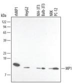 LAMTOR3 Monoclonal Antibody (448406)