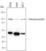 NR3C2 Monoclonal Antibody (385707)