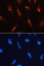 TCF3 Monoclonal Antibody (401709)