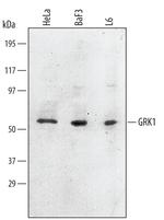 GRK1 Monoclonal Antibody (466630)
