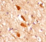 mGluR5 Monoclonal Antibody (464823)