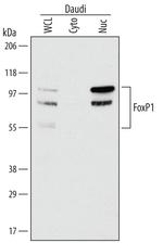 FOXP1 Monoclonal Antibody (542721)