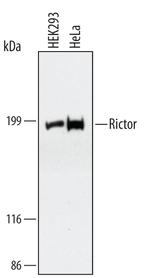 RICTOR Monoclonal Antibody (454313)