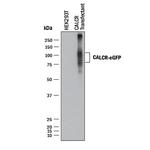 Calcitonin Receptor Antibody in Western Blot (WB)