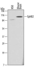 EphB2 Monoclonal Antibody (512013)