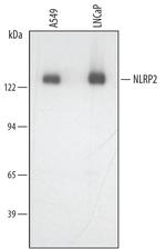 NALP2 Monoclonal Antibody (443625)