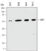 GRK7 Monoclonal Antibody (496831)