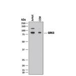 GRK3 Monoclonal Antibody (497007)